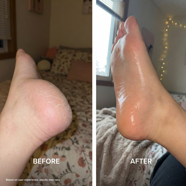 Antes e depois